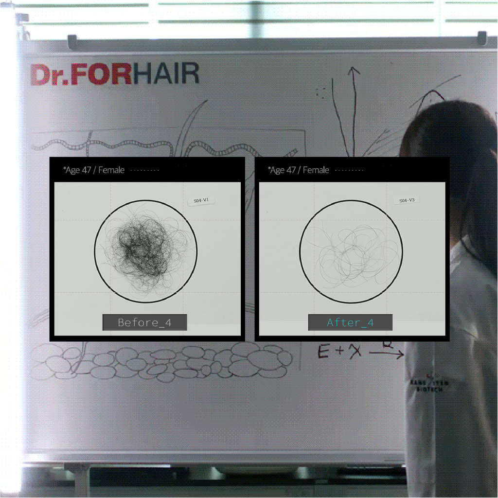 Dr.FORHAIR Bio-3 Folligen Shampoo 4